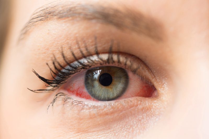 A woman with intense red eyes and a single red eye, creating a mesmerizing and enigmatic look.