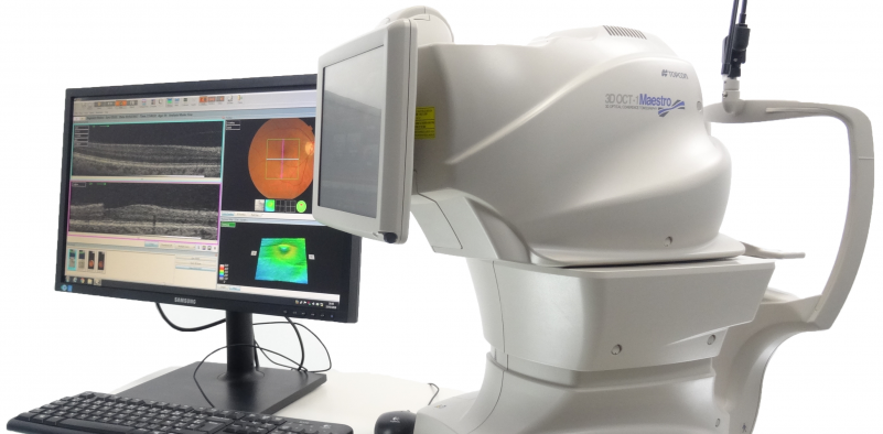 A computer monitor and a OCT eye scan on a desk